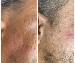 Cicera Fuzeta - Terapeuta capilar integrativa - Fotos (3)